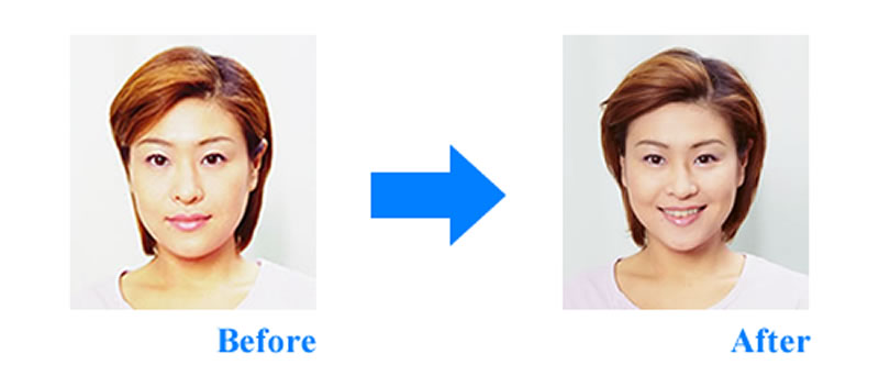 １回の施術で驚きの効果。その差は一目瞭然です